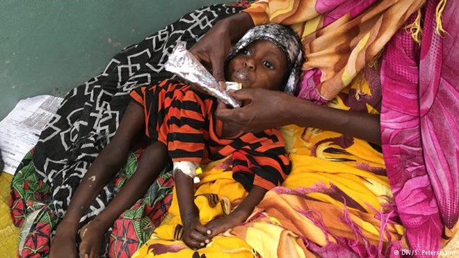 Hawa squeezes high-energy peanut butter paste into her daughter's mouth